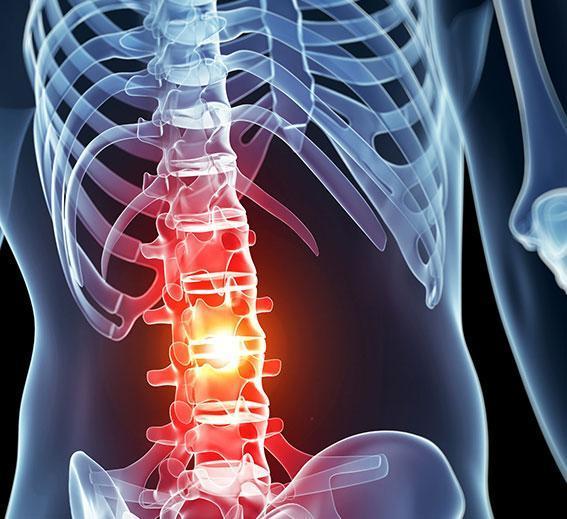Spinal-Cord-Injuries